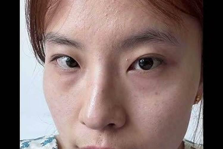 为什么女人鼻梁有节千万不要娶