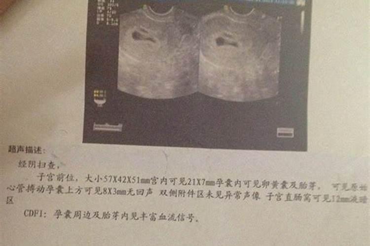 经历人工流产的胎儿,最后都到哪里去了？