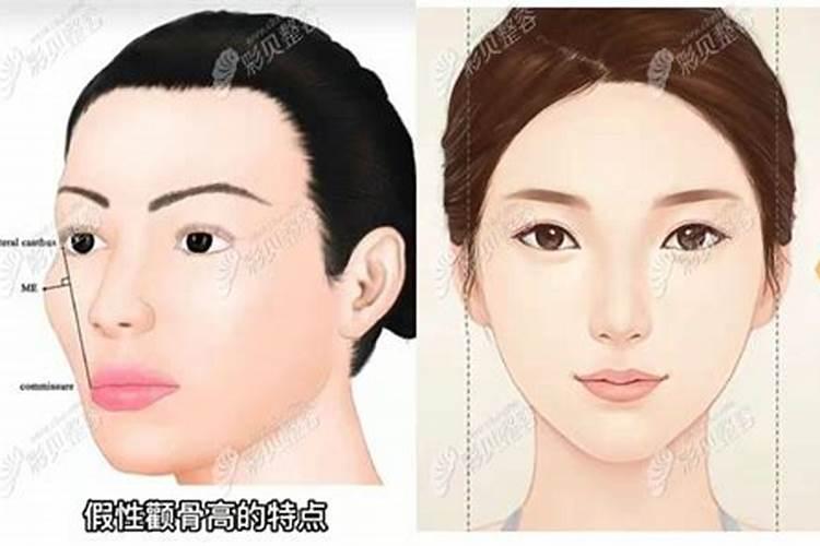 颧骨高克夫还是旺夫颧骨高克夫怎么化解