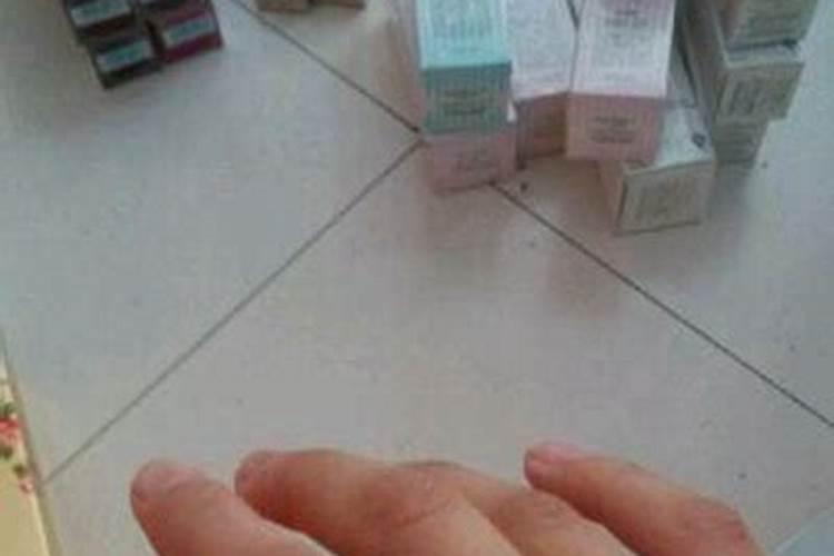 梦见手指头划破滴出血的预兆