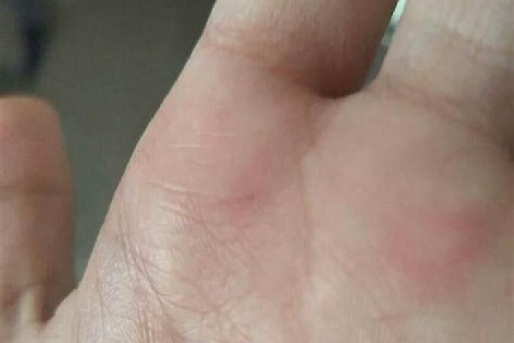 梦见用刀划破手流血一会就好了的预兆