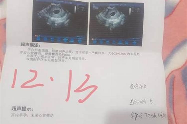 人流手术55天做合适吗