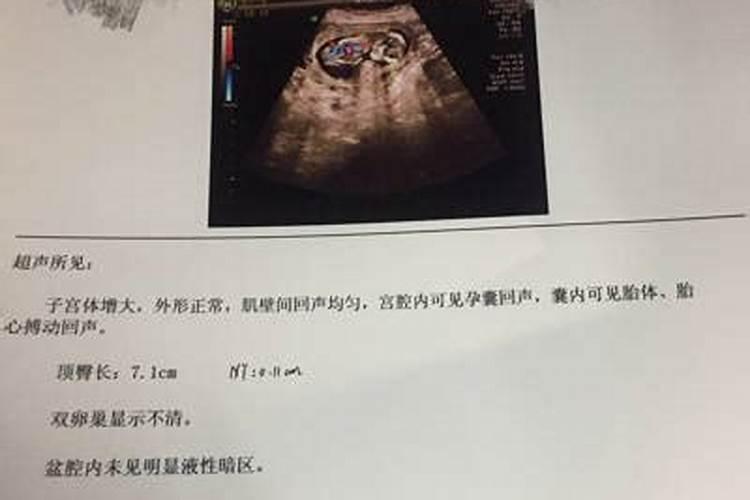 【打胎没满月可以去别人家吗】打胎没满月能去别人家吗