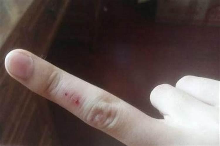 梦见别人手受伤流血什么意思？