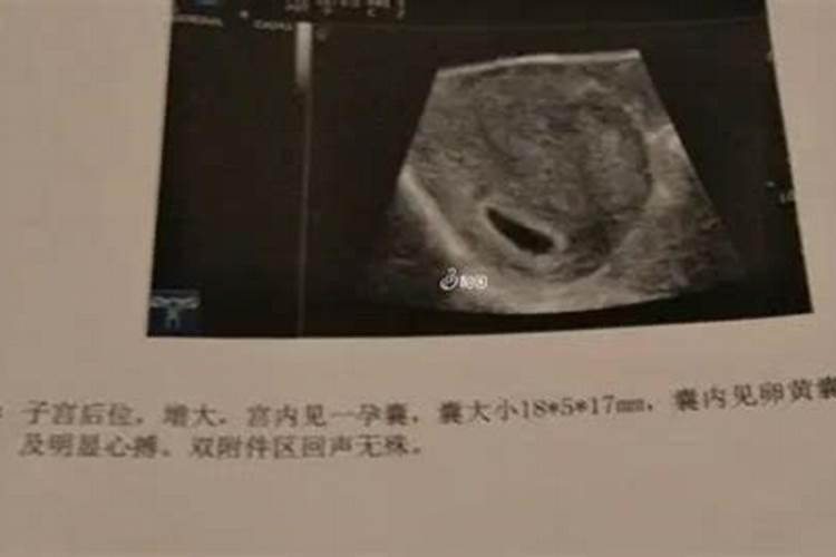 要是想生儿子有什么办法增加几率的？怎么样生男孩几率高呢？