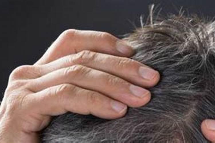 梦见死人复活全是白头发