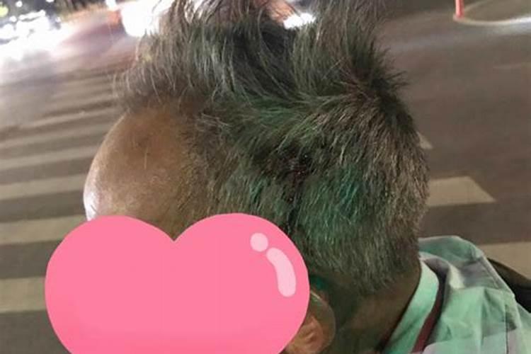 梦见婆婆摔倒头流血