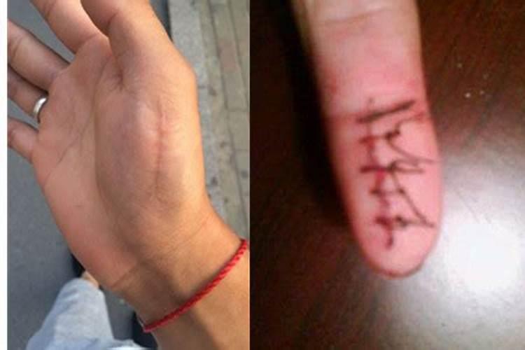 右脸顿受伤,缝针,对个人运势,有什么影响
