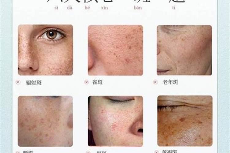 佛说女人脸上长斑因果