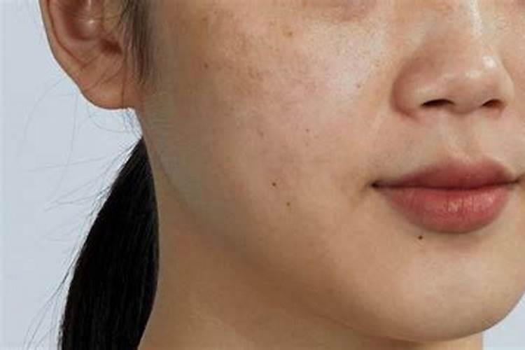 女人脸上长斑面相