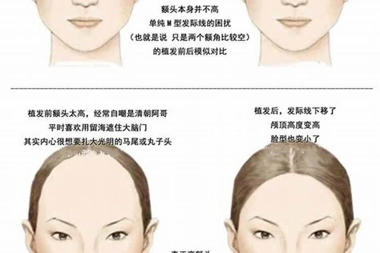 发际线低是命苦吗,运势如何