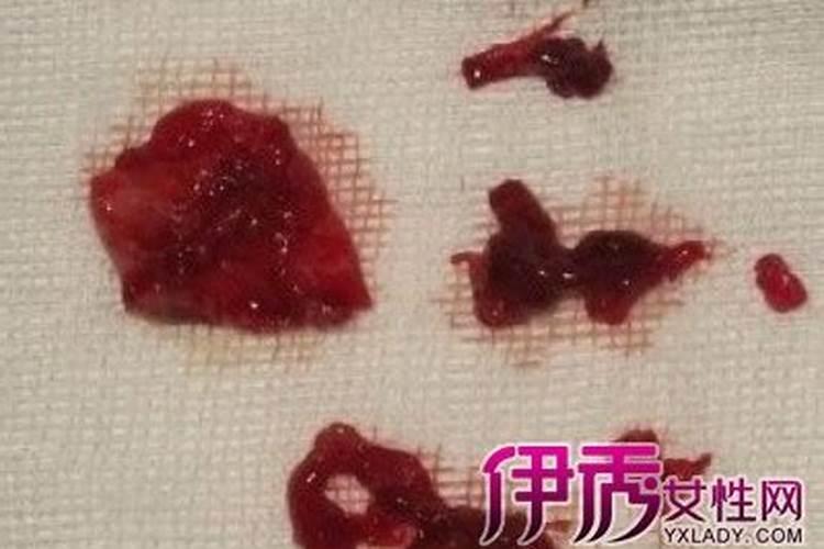 梦见裤子上有经血是什么预兆？
