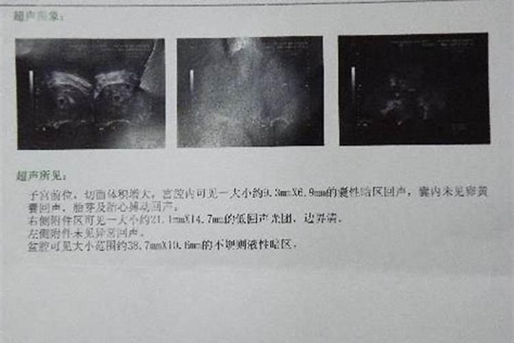 八字预测怀孕很准,无需精准八字,六爻预测何时怀孕,排盘方法见顶楼百 ...