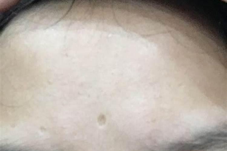 男人人中有大的的伤疤对命运有没有什么影响