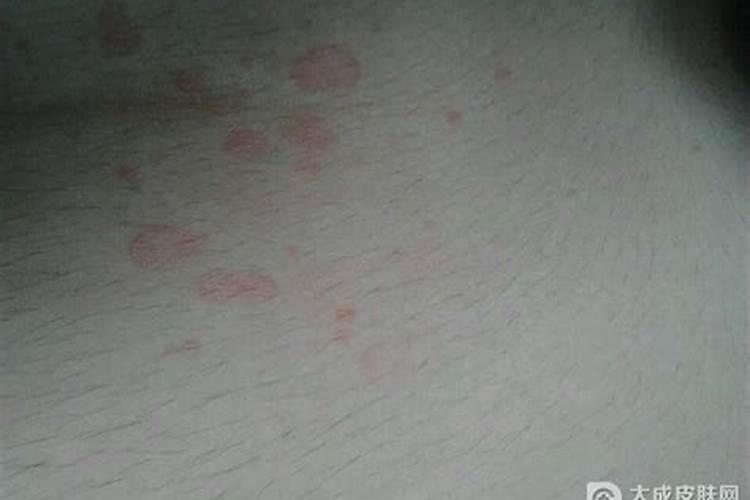 梦见妻子满身红斑的预兆