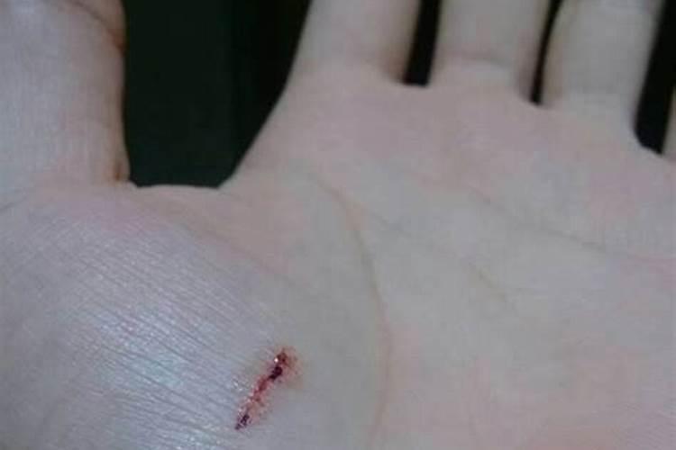 梦见手流血缝针的预兆