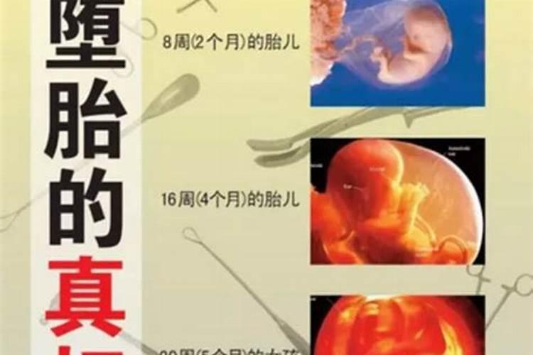 堕胎有没有报应