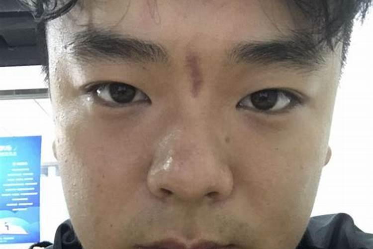 眉心发红是什么的征兆