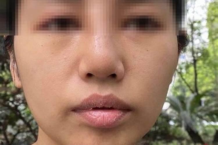 玄学中鼻子歪预示什么