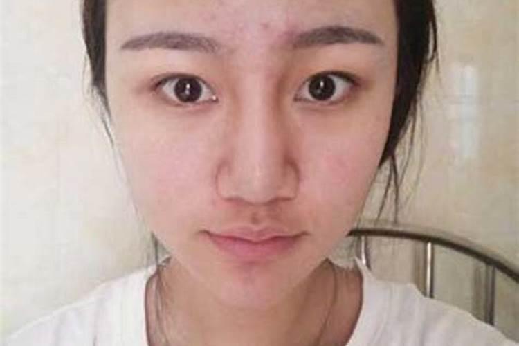 鼻子歪了是什么预兆