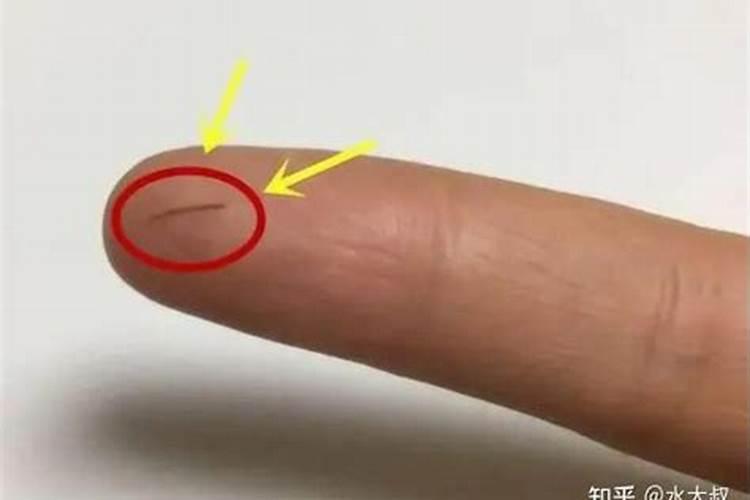 梦见自己手上扎个刺的预兆