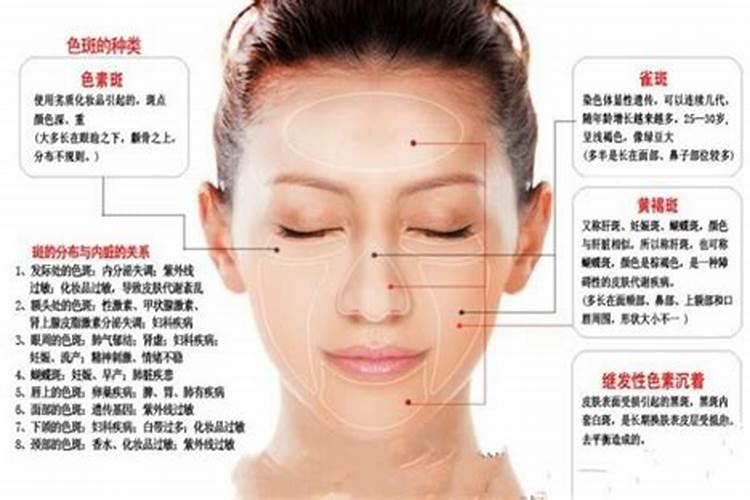 额头上长痣代表什么