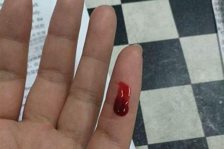 梦见自己的手在流血的预兆