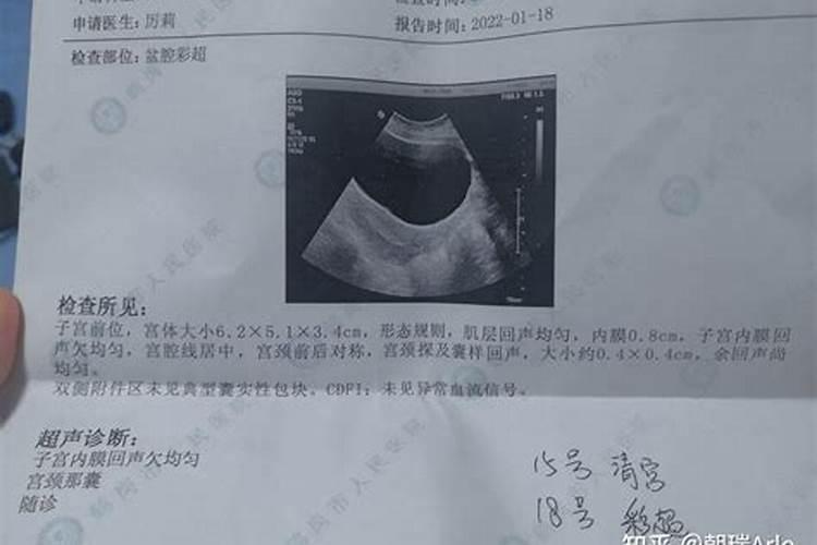 梦见前妻怀孕了是什么意思