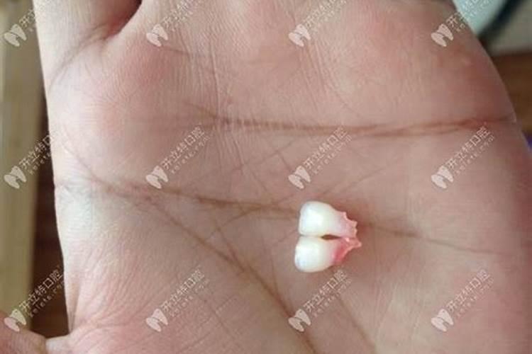 本命年怎么化解不利 本命年怎么避免倒霉事