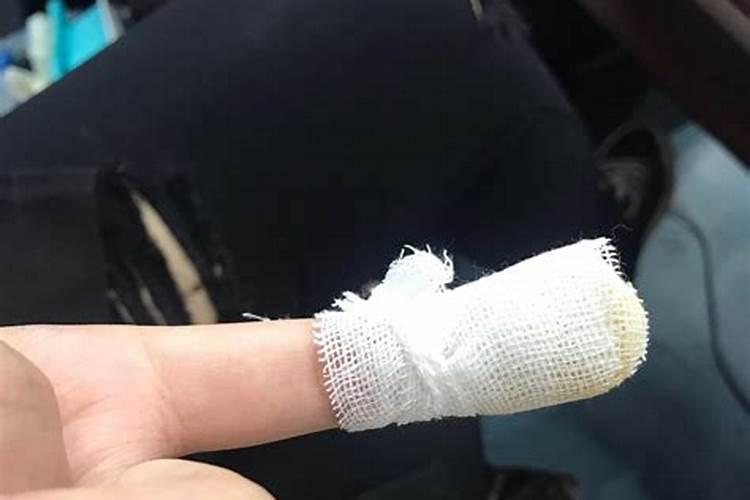 面部疤痕会影响运势吗？
