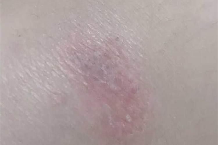 女生痣相与命运图解 部位不同人生运势有所差？