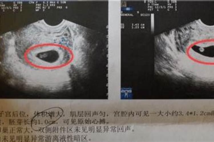 端午节出生的女人命好不好？
