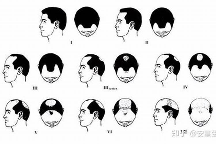 女人梦见发际线后移