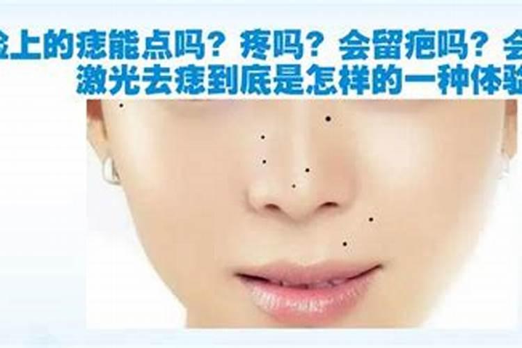 点痣会影响运势吗