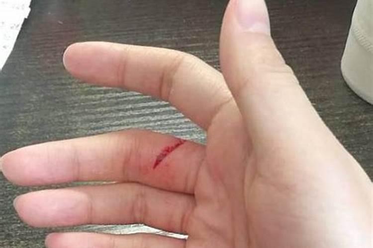 正月手指头被刀切了,运气好不好？