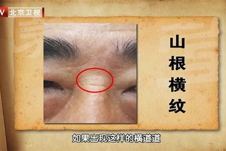 山根分析,山根有横纹是怎么回事？