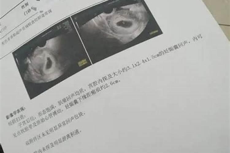 怀孕42天打胎算是伤害生命吗,怀孕四个月能打胎吗,有危险吗