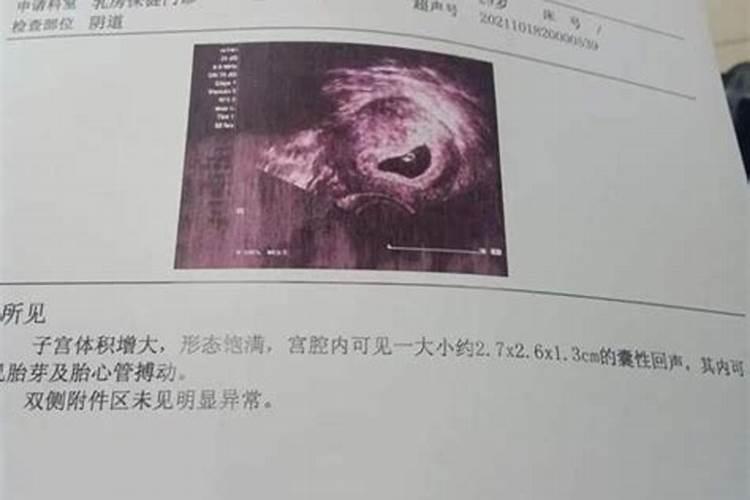 自然流产后多久能同房 自然流产后吃什么补