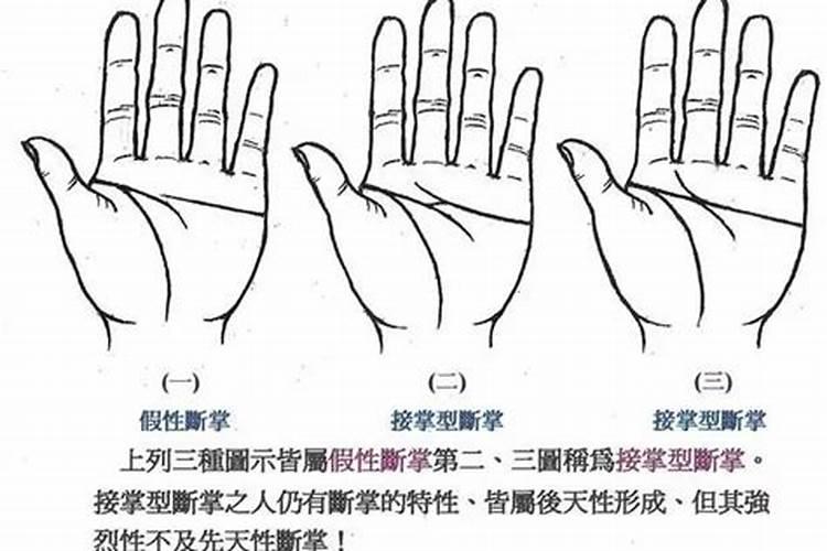 两只手都是断手掌纹的男孩命运 两个手都是断掌的男人