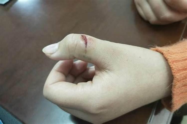 梦见手被割破流血自己还舔了