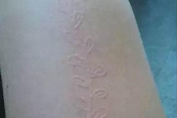 梦见腰上紫了一块