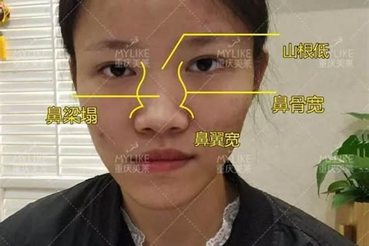女人鼻梁中间凸起命运