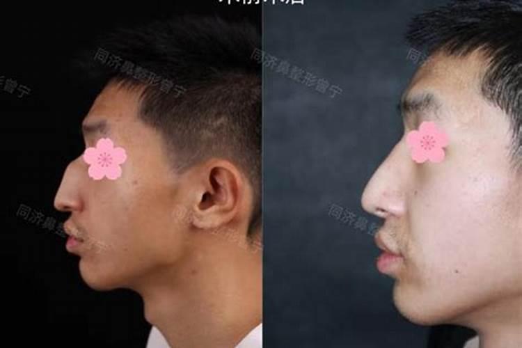 女人鼻梁中间凸起命运
