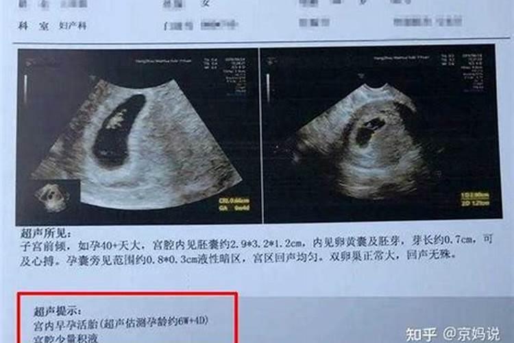堕胎孩子如何超度？