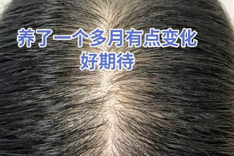 女人梦到前额秃了是什么意思