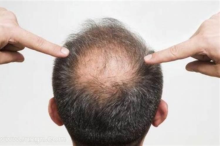 梦见自己秃头是什么意思,预示着什么？