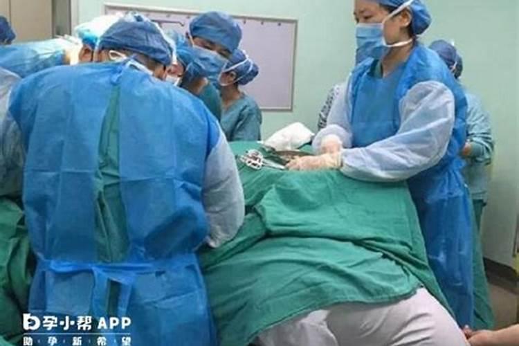 剖腹产选日子怎么选
