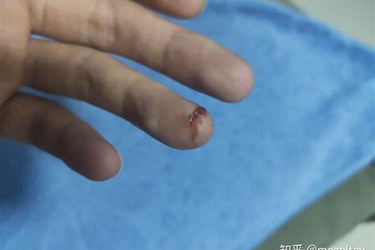 梦见手被割破一个很深的口子的预兆