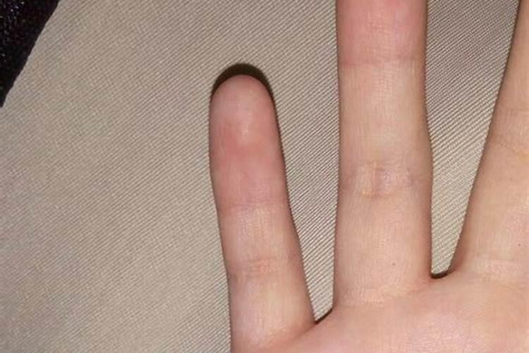 梦到自己手被刀划破出血是什么预兆？