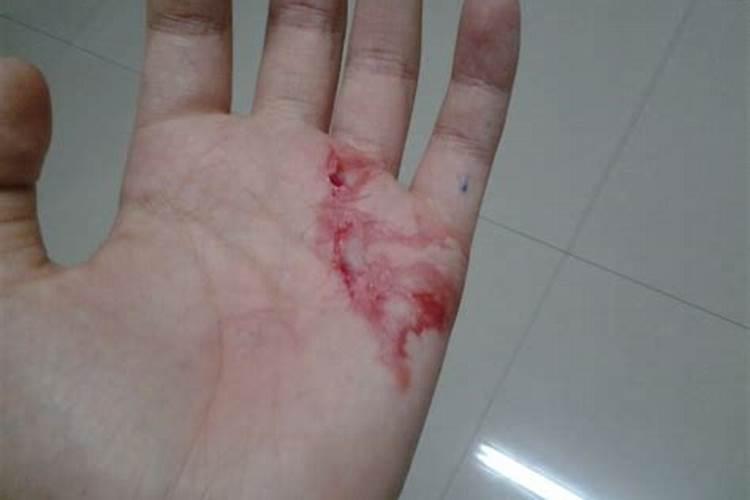 梦见自己被刀划破了手的预兆